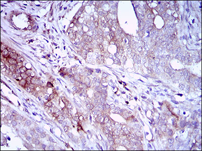 Immunohistochemistry (Formalin/PFA-fixed paraffin-embedded sections) - Anti-CD22 antibody [2H1C4] (AB181771)