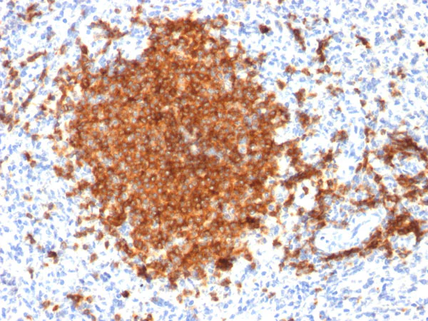 Immunohistochemistry (Formalin/PFA-fixed paraffin-embedded sections) - Anti-CD22 antibody [BLCAM/1795] (AB218340)