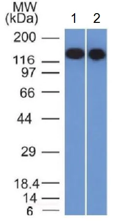 Western blot - Anti-CD22 antibody [BLCAM/1795] (AB218340)