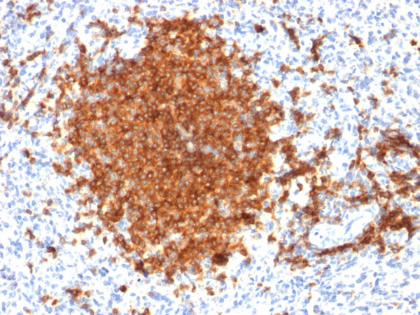 Immunohistochemistry (Formalin/PFA-fixed paraffin-embedded sections) - Anti-CD22 antibody [BLCAM/1795] - BSA and Azide free (AB269755), expandable thumbnail