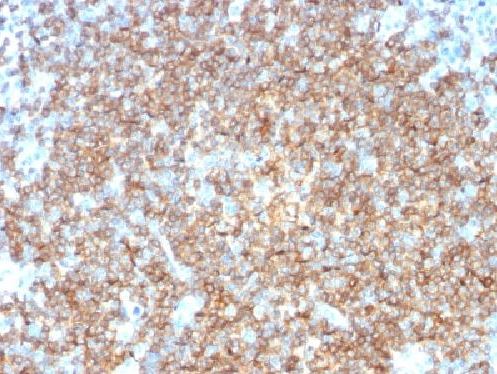 Immunohistochemistry (Formalin/PFA-fixed paraffin-embedded sections) - Anti-CD22 antibody [BLCAM/1795] - BSA and Azide free (AB269755), expandable thumbnail