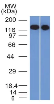 Western blot - Anti-CD22 antibody [BLCAM/1795] - BSA and Azide free (AB269755)