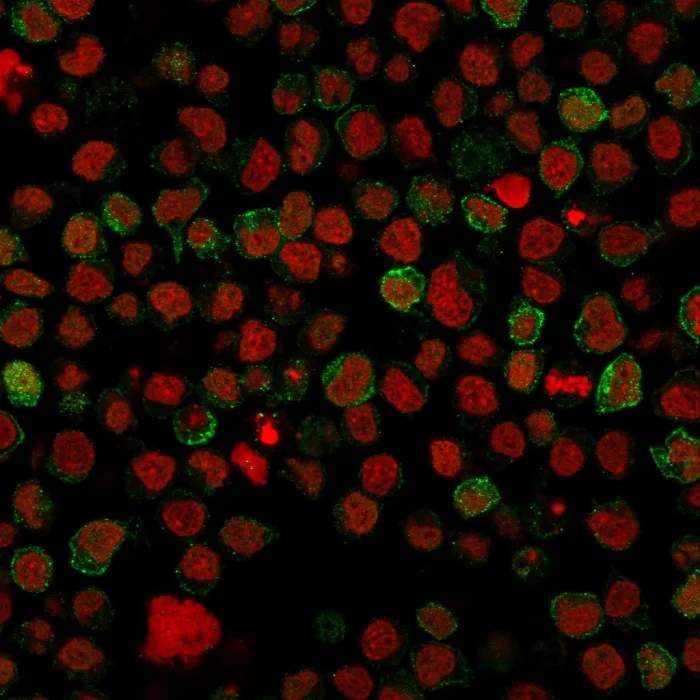 Immunocytochemistry - Anti-CD22 antibody [BLCAM/1796] (AB223801)