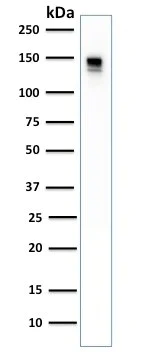 Western blot - Anti-CD22 antibody [BLCAM/1796] (AB223801)