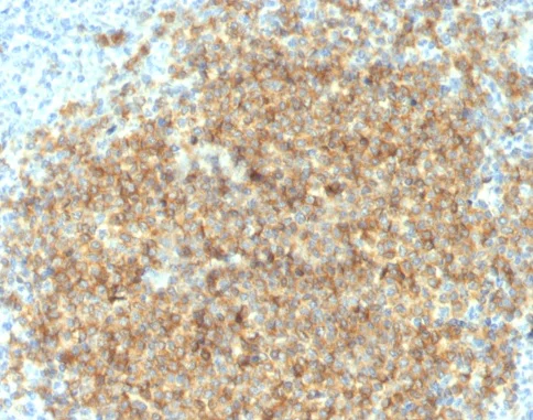 Immunohistochemistry (Formalin/PFA-fixed paraffin-embedded sections) - Anti-CD22 antibody [BLCAM/1796] - BSA and Azide free (AB223802)