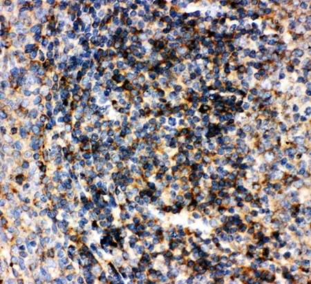 Immunohistochemistry (Formalin/PFA-fixed paraffin-embedded sections) - Anti-CD22 antibody - C-terminal (AB197650)