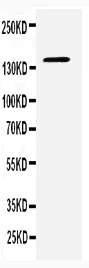 Western blot - Anti-CD22 antibody - C-terminal (AB197650)