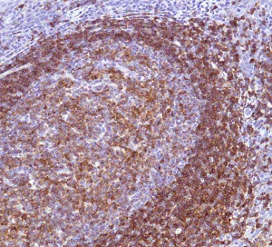 Immunohistochemistry (Formalin/PFA-fixed paraffin-embedded sections) - Anti-CD22 antibody - C-terminal (AB227787)