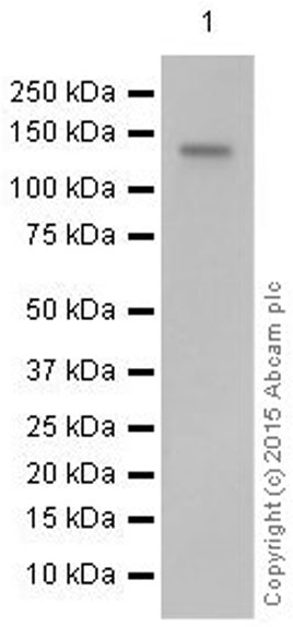 Western blot - Anti-CD22 antibody [EP498Y] (AB33859)