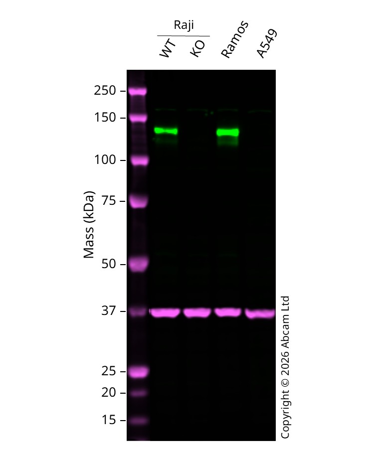 Western blot - Anti-CD22 antibody [EP498Y] (AB33859)