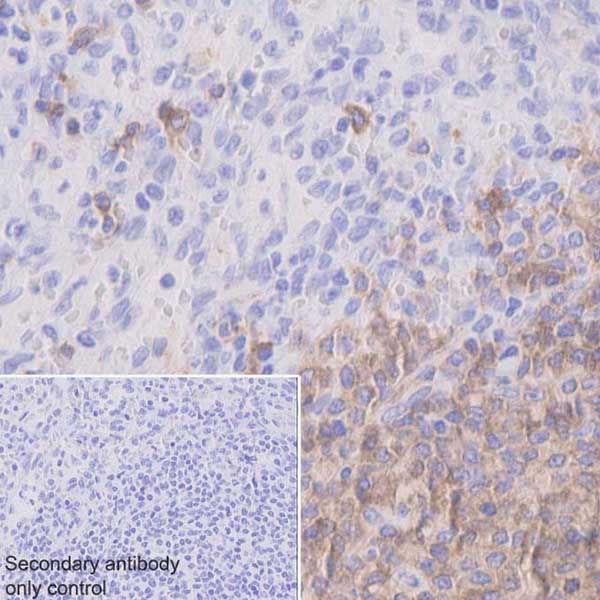 その他 Antibodies [DVD] Anti-CD22 antibody [EPR20061] (ab207727) | Abcam