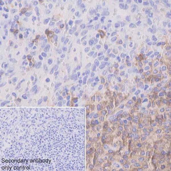 Immunohistochemistry (Formalin/PFA-fixed paraffin-embedded sections) - Anti-CD22 antibody [EPR20061] (AB207727)