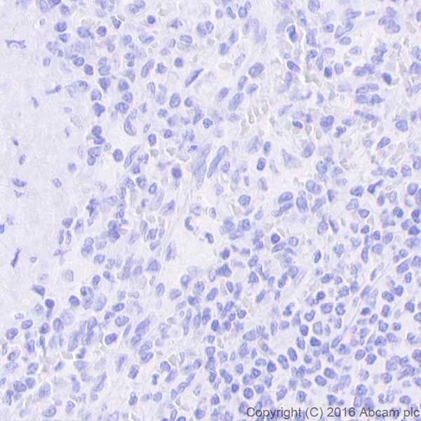Immunohistochemistry (Formalin/PFA-fixed paraffin-embedded sections) - Anti-CD22 antibody [EPR20061] (AB207727)