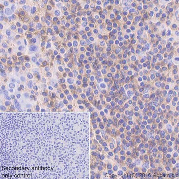 Anti-CD22 antibody [EPR20061] (ab207727) | Abcam