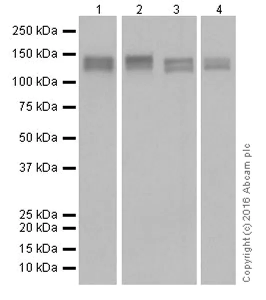 Western blot - Anti-CD22 antibody [EPR20061] (AB207727)