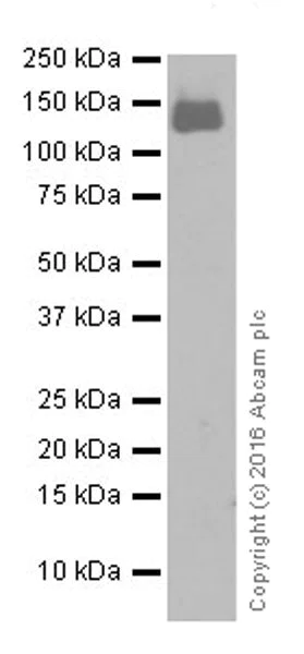 Western blot - Anti-CD22 antibody [EPR20061] (AB207727)