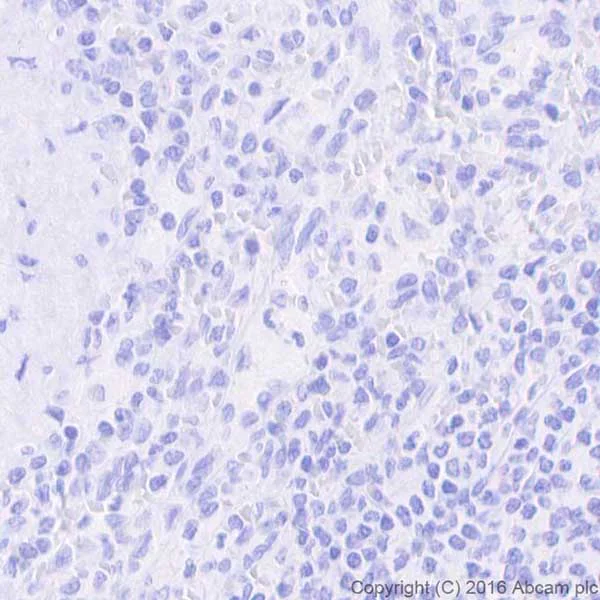 Immunohistochemistry (Formalin/PFA-fixed paraffin-embedded sections) - Anti-CD22 antibody [EPR20061] - BSA and Azide free (AB246334)