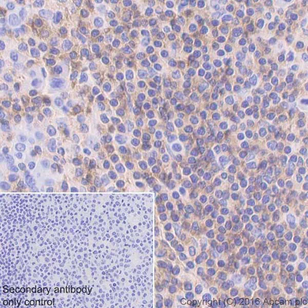 Immunohistochemistry (Formalin/PFA-fixed paraffin-embedded sections) - Anti-CD22 antibody [EPR20061] - BSA and Azide free (AB246334)