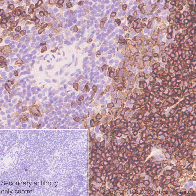 Immunohistochemistry (Formalin/PFA-fixed paraffin-embedded sections) - Anti-CD22 antibody [EPR30959-12] (AB326044)