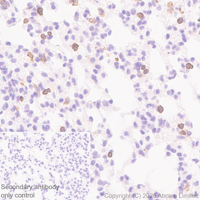 Immunohistochemistry (Formalin/PFA-fixed paraffin-embedded sections) - Anti-CD22 antibody [EPR30959-12] (AB326044)
