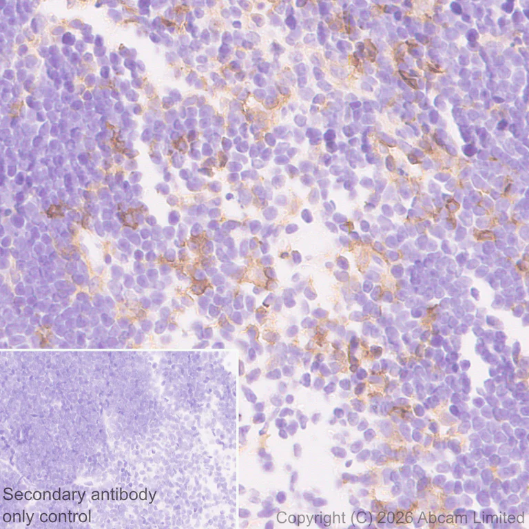 Immunohistochemistry (Formalin/PFA-fixed paraffin-embedded sections) - Anti-CD22 antibody [EPR30959-12] (AB326044)