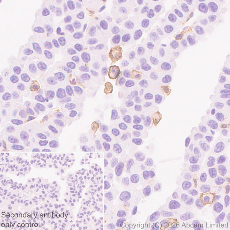 Immunohistochemistry (Formalin/PFA-fixed paraffin-embedded sections) - Anti-CD22 antibody [EPR30959-12] (AB326044)