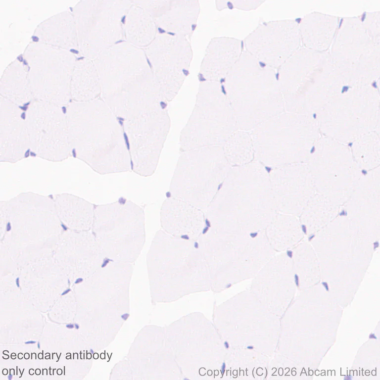Immunohistochemistry (Formalin/PFA-fixed paraffin-embedded sections) - Anti-CD22 antibody [EPR30959-12] (AB326044)