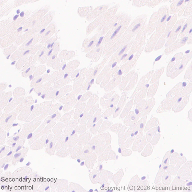 Immunohistochemistry (Formalin/PFA-fixed paraffin-embedded sections) - Anti-CD22 antibody [EPR30959-12] (AB326044)