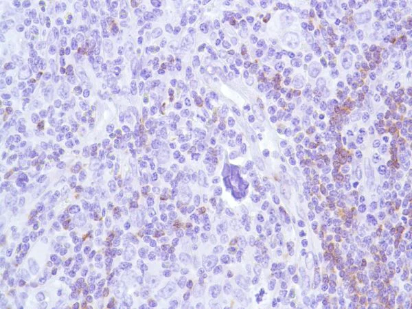 Immunohistochemistry (Formalin/PFA-fixed paraffin-embedded sections) - Anti-CD22 antibody [SP104] - BSA and Azide free (AB240404)