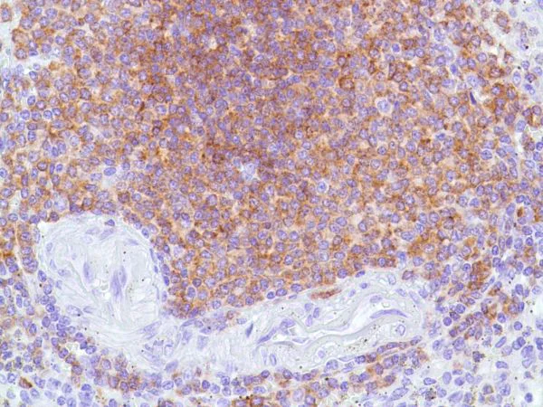 Immunohistochemistry (Formalin/PFA-fixed paraffin-embedded sections) - Anti-CD22 antibody [SP104] - C-terminal (AB227645)