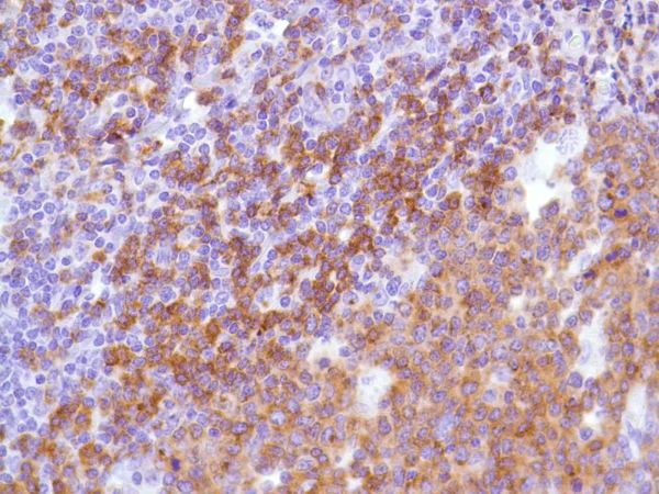 Immunohistochemistry (Formalin/PFA-fixed paraffin-embedded sections) - Anti-CD22 antibody [SP104] - C-terminal (AB227645)
