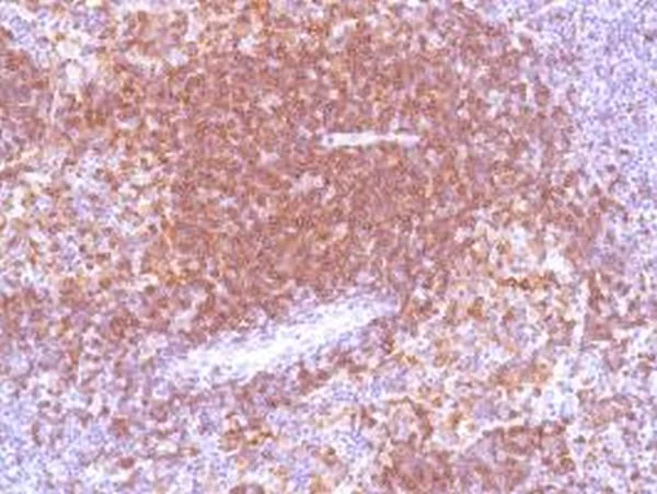 Immunohistochemistry (Formalin/PFA-fixed paraffin-embedded sections) - Anti-CD22 antibody [SP104] - C-terminal (AB227645)