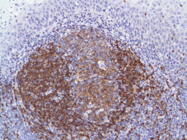 Immunohistochemistry (Formalin/PFA-fixed paraffin-embedded sections) - Anti-CD22 antibody [SP104] - C-terminal (AB227645)