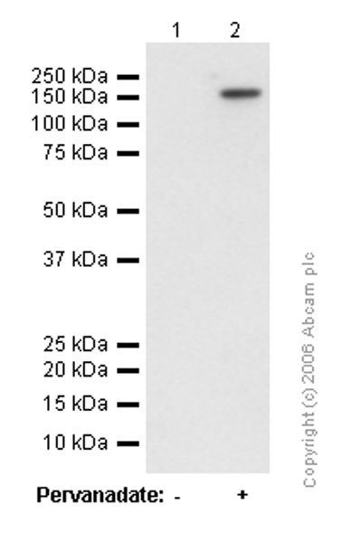 Western blot - Anti-CD22 (phospho Y762) antibody [EP727Y] (AB45135)