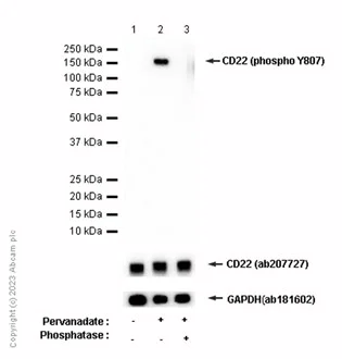 Western blot - Anti-CD22 (phospho Y807) antibody [Y505] - BSA and Azide free (AB247213)