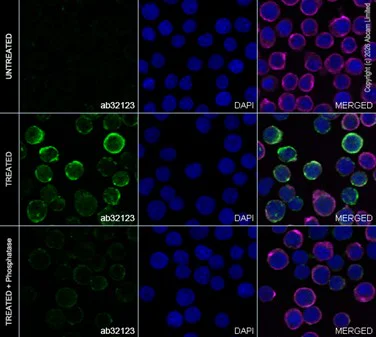 Immunocytochemistry/ Immunofluorescence - Anti-CD22 (phospho Y822) antibody [Y506] (AB32123)