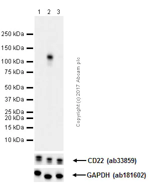 Western blot - Anti-CD22 (phospho Y822) antibody [Y506] (AB32123)
