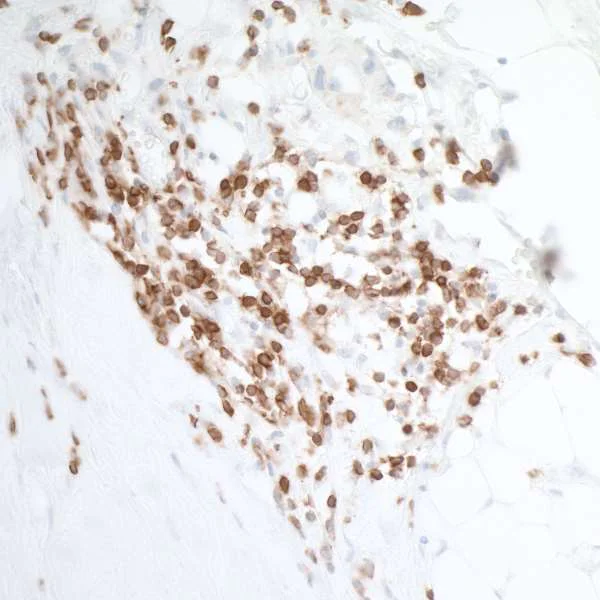 Immunohistochemistry (Formalin/PFA-fixed paraffin-embedded sections) - Anti-CD226 antibody [BLR063G] - BSA free (AB264415)