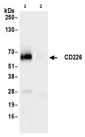 Immunoprecipitation - Anti-CD226 antibody [BLR063G] - BSA free (AB264415)