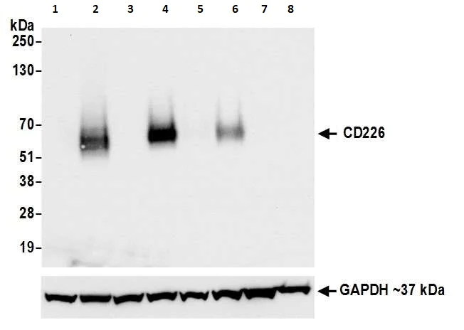 Western blot - Anti-CD226 antibody [BLR063G] - BSA free (AB264415)