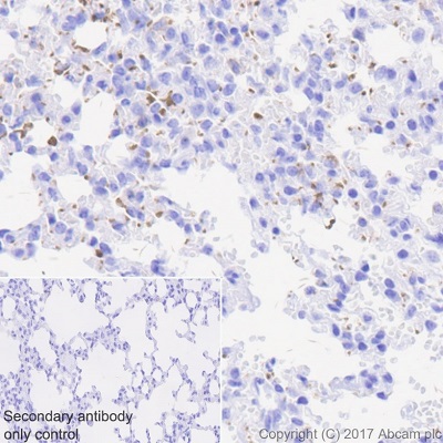 Immunohistochemistry (Formalin/PFA-fixed paraffin-embedded sections) - Anti-CD226 antibody [EPR20710] - BSA and Azide free (AB251537), expandable thumbnail