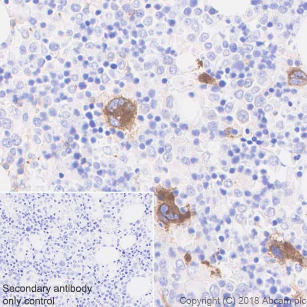 Immunohistochemistry (Formalin/PFA-fixed paraffin-embedded sections) - Anti-CD226 antibody [EPR21172] (AB212076)