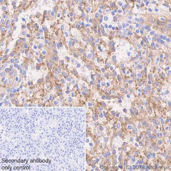 Immunohistochemistry (Formalin/PFA-fixed paraffin-embedded sections) - Anti-CD226 antibody [EPR21172] - BSA and Azide free (AB230865)