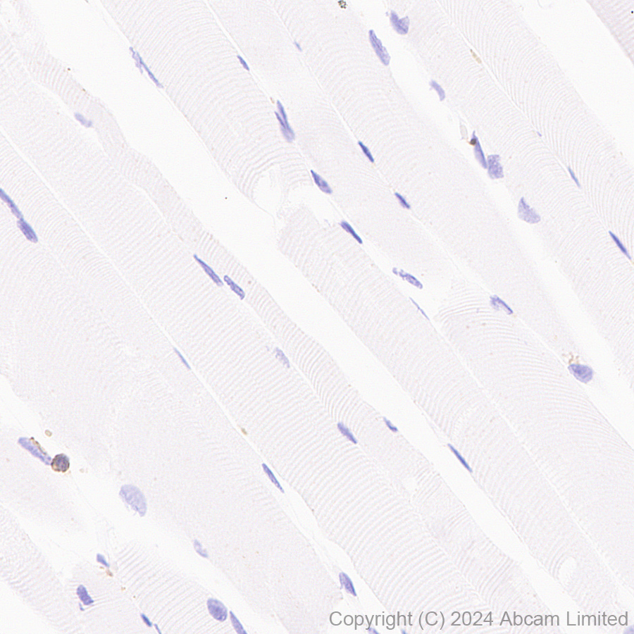 Immunohistochemistry (Formalin/PFA-fixed paraffin-embedded sections) - Anti-CD226 antibody [RM2068] (AB320009)