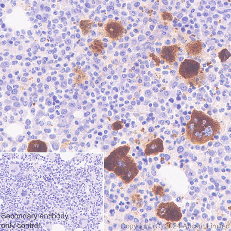 Immunohistochemistry (Formalin/PFA-fixed paraffin-embedded sections) - Anti-CD226 antibody [RM2068] - BSA and Azide free (AB320010)