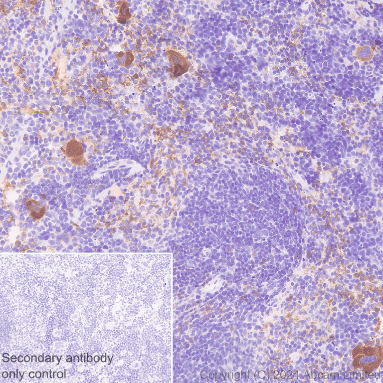 Immunohistochemistry (Formalin/PFA-fixed paraffin-embedded sections) - Anti-CD226 antibody [RM2068] - BSA and Azide free (AB320010)