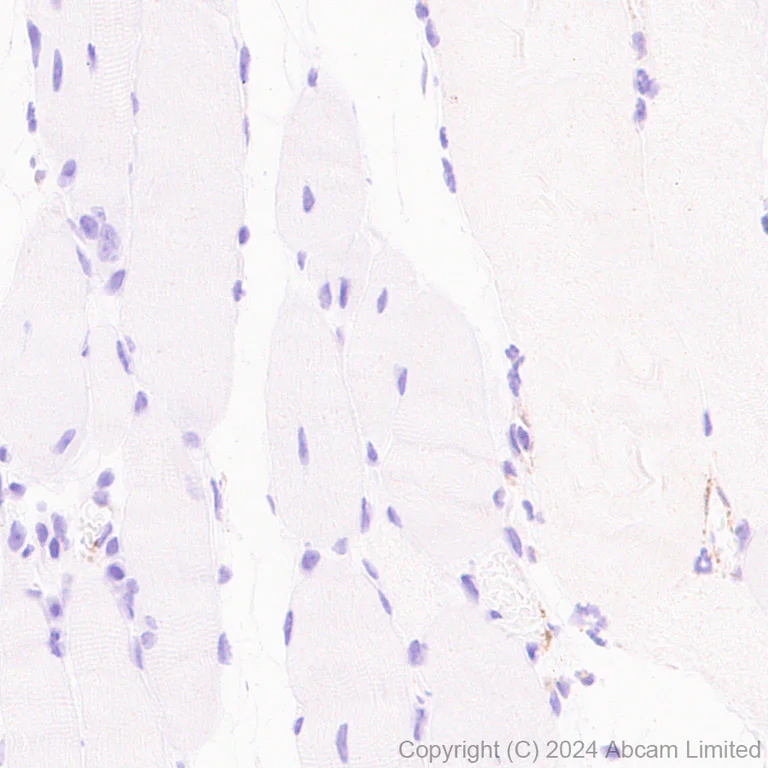 Immunohistochemistry (Formalin/PFA-fixed paraffin-embedded sections) - Anti-CD226 antibody [RM2068] - BSA and Azide free (AB320010)