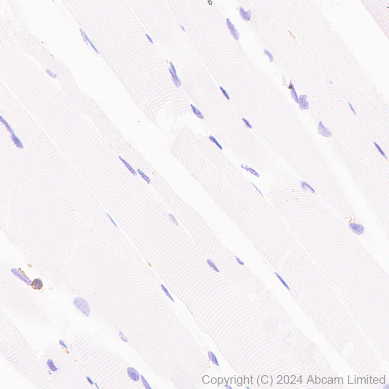 Immunohistochemistry (Formalin/PFA-fixed paraffin-embedded sections) - Anti-CD226 antibody [RM2068] - BSA and Azide free (AB320010)