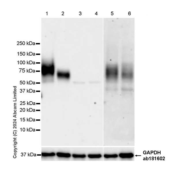 Western blot - Anti-CD226 antibody [RM2068] - BSA and Azide free (AB320010)