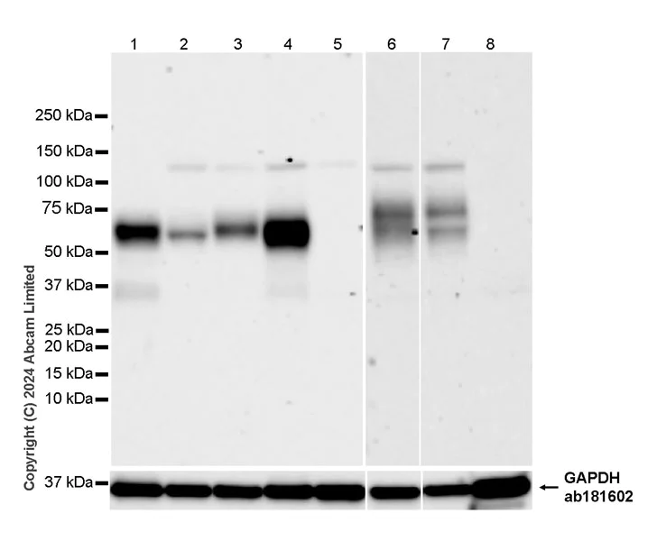 Western blot - Anti-CD226 antibody [RM2068] - BSA and Azide free (AB320010)